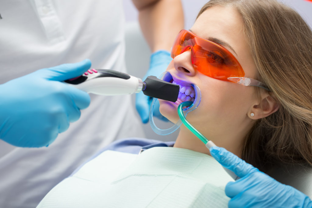Zahn-Bleaching beim Zahnarzt ©shutterstock.com